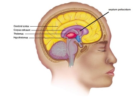 cerebral hemisphere