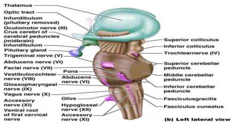 brainstem lateral